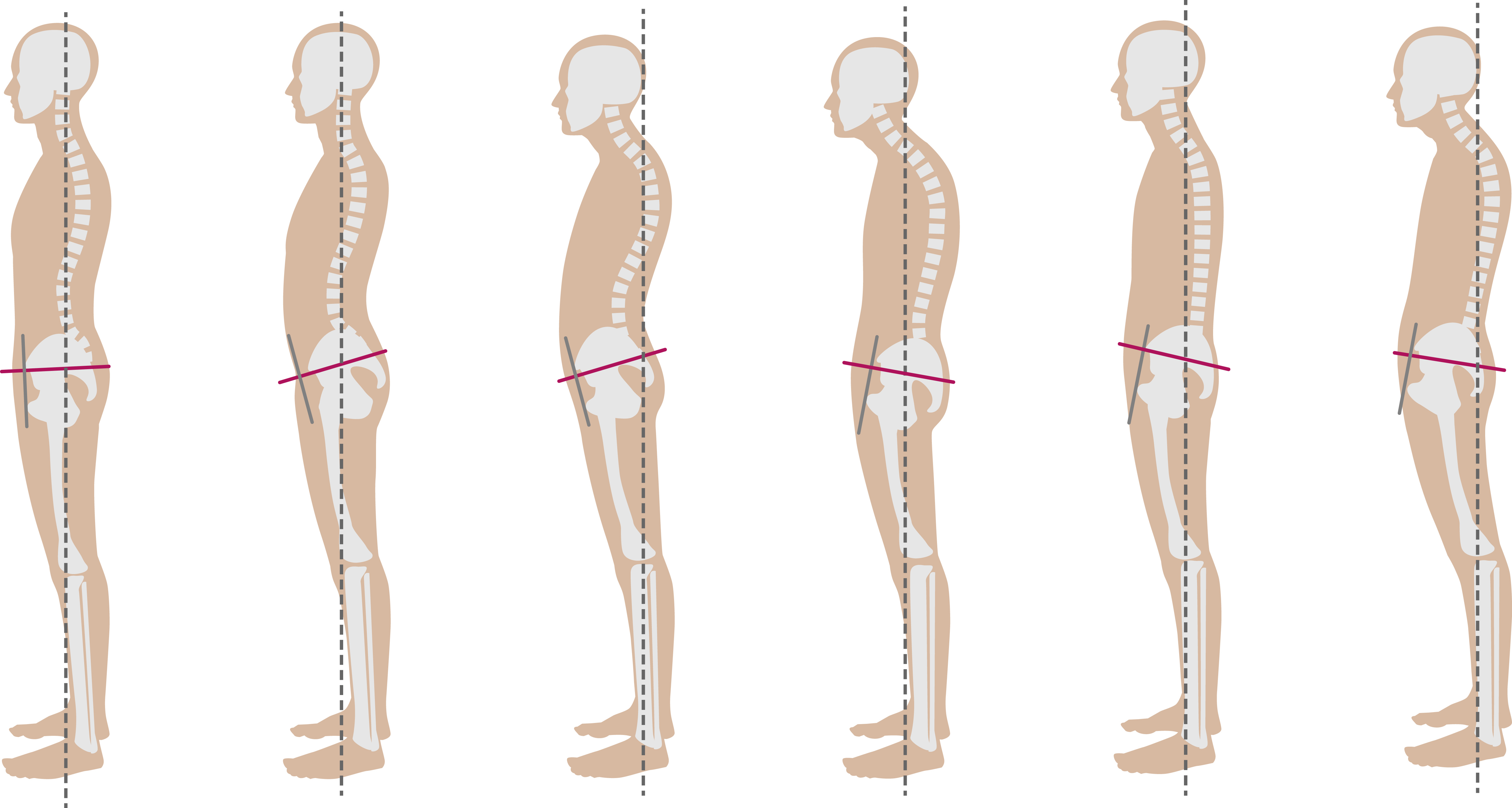 股関節の連動性